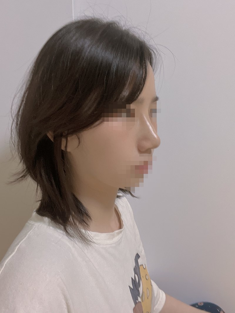 수술후기이미지