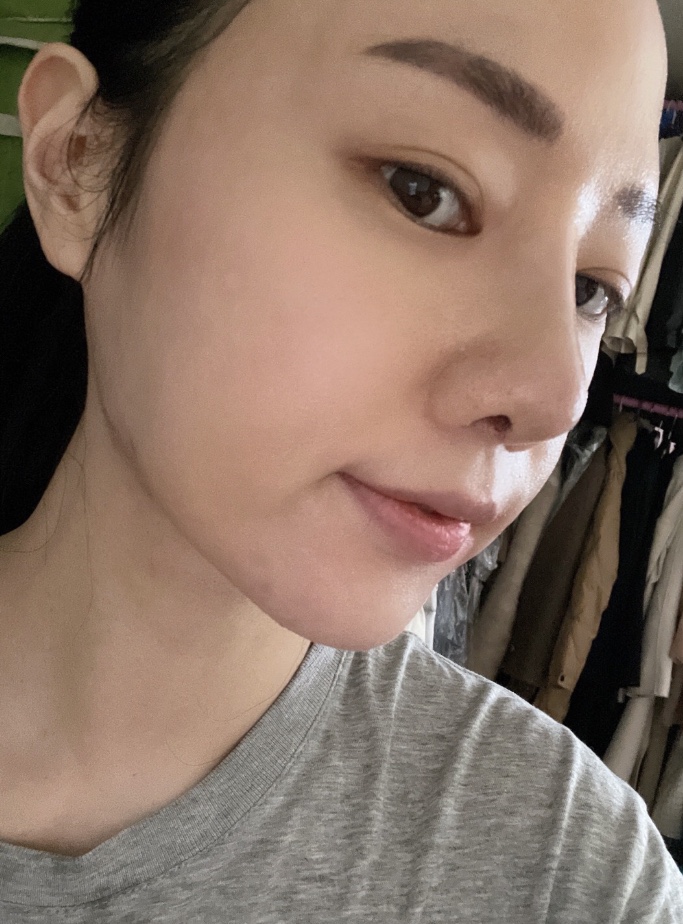 수술후기이미지