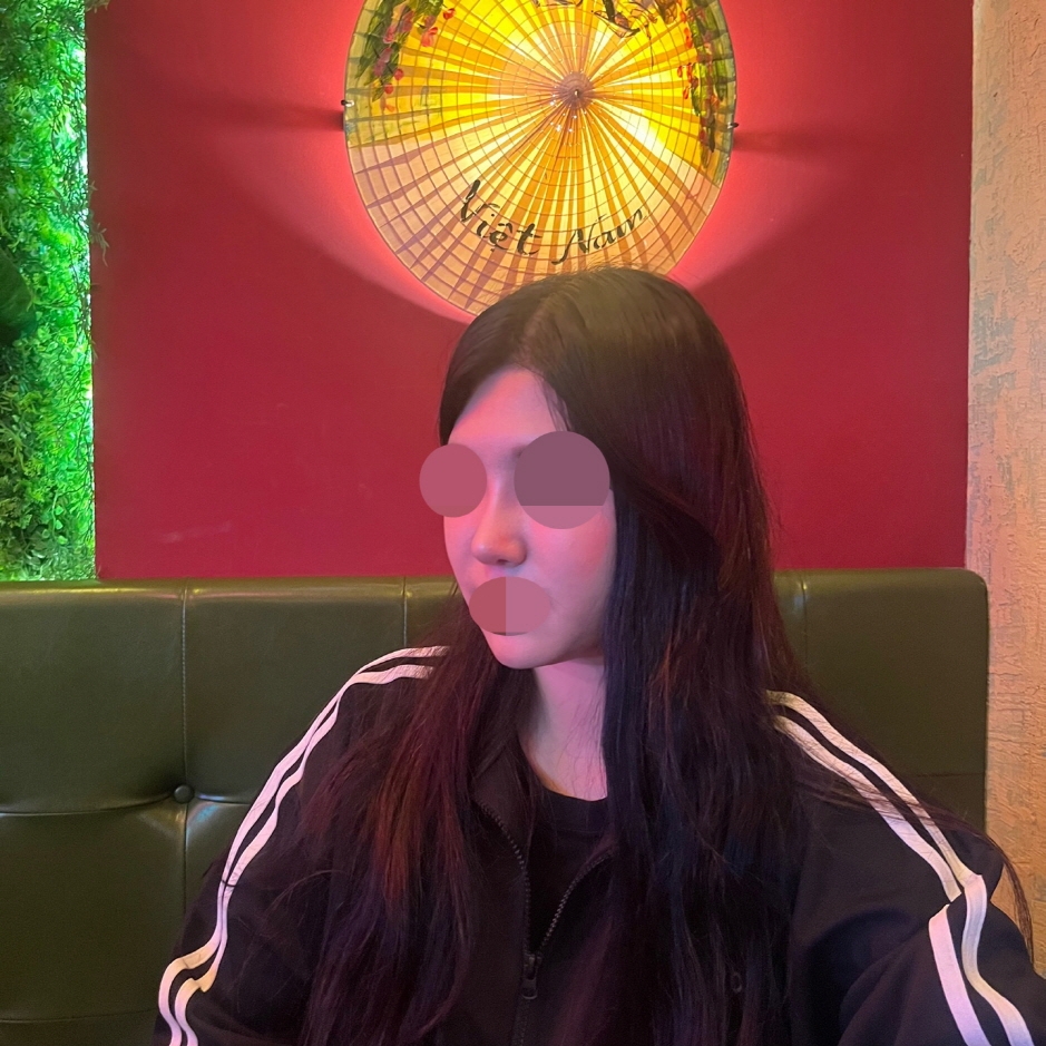 수술후기이미지