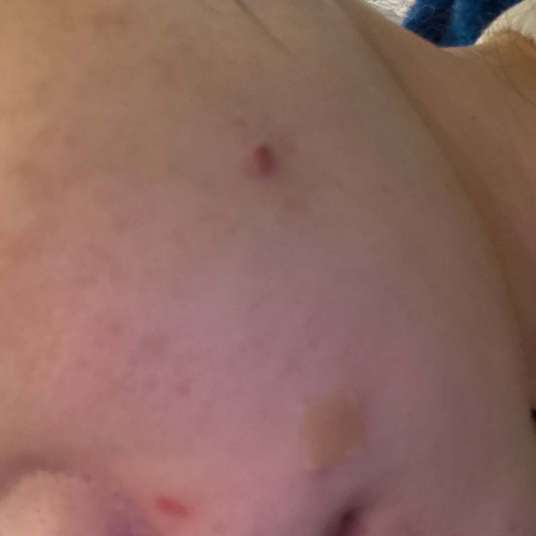 수술후기이미지