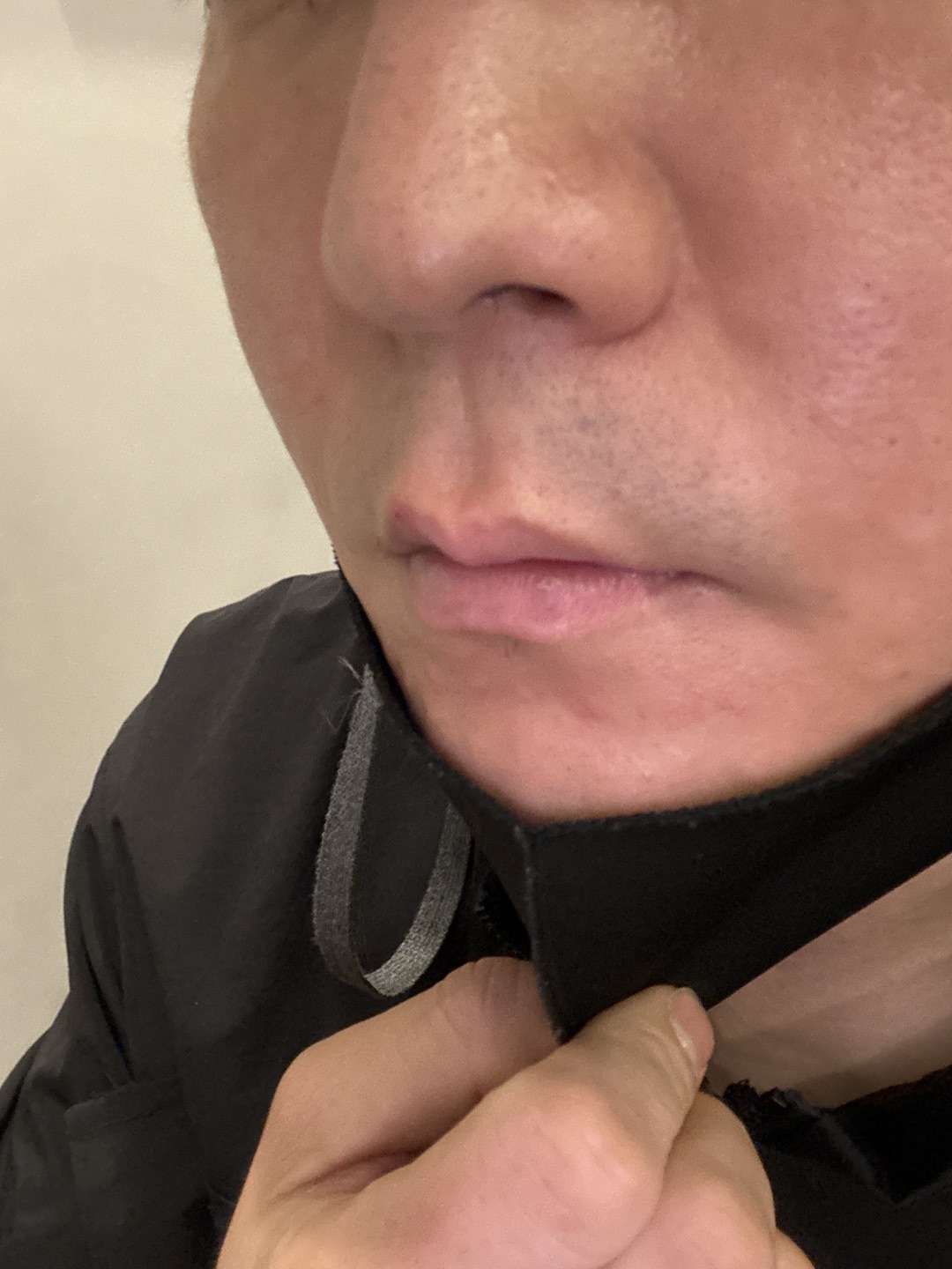 수술후기이미지