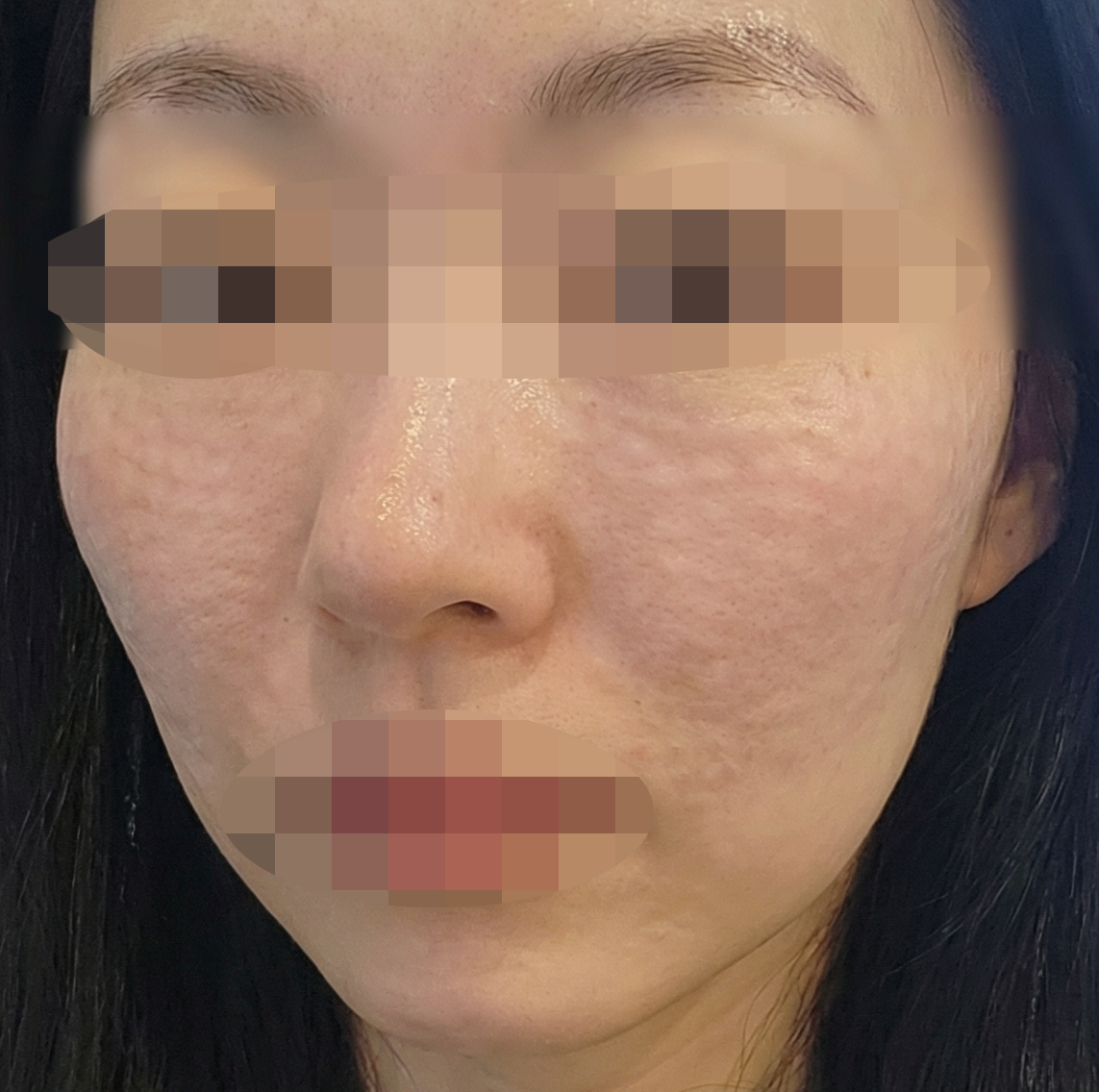 수술후기이미지