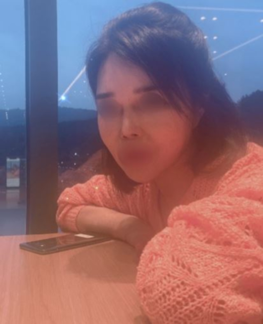 수술후기이미지