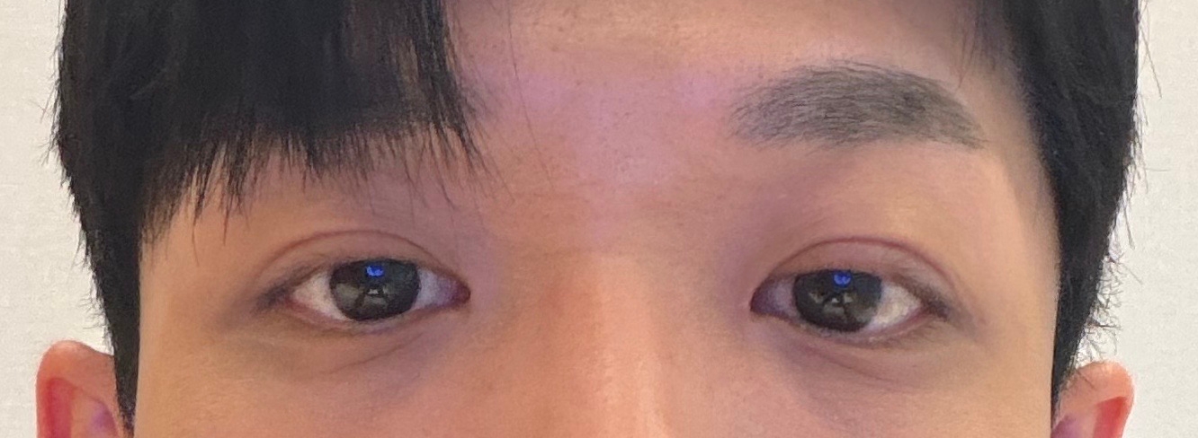 수술후기이미지