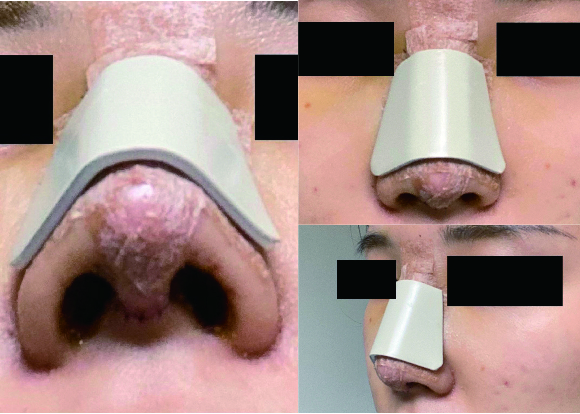 수술후기이미지