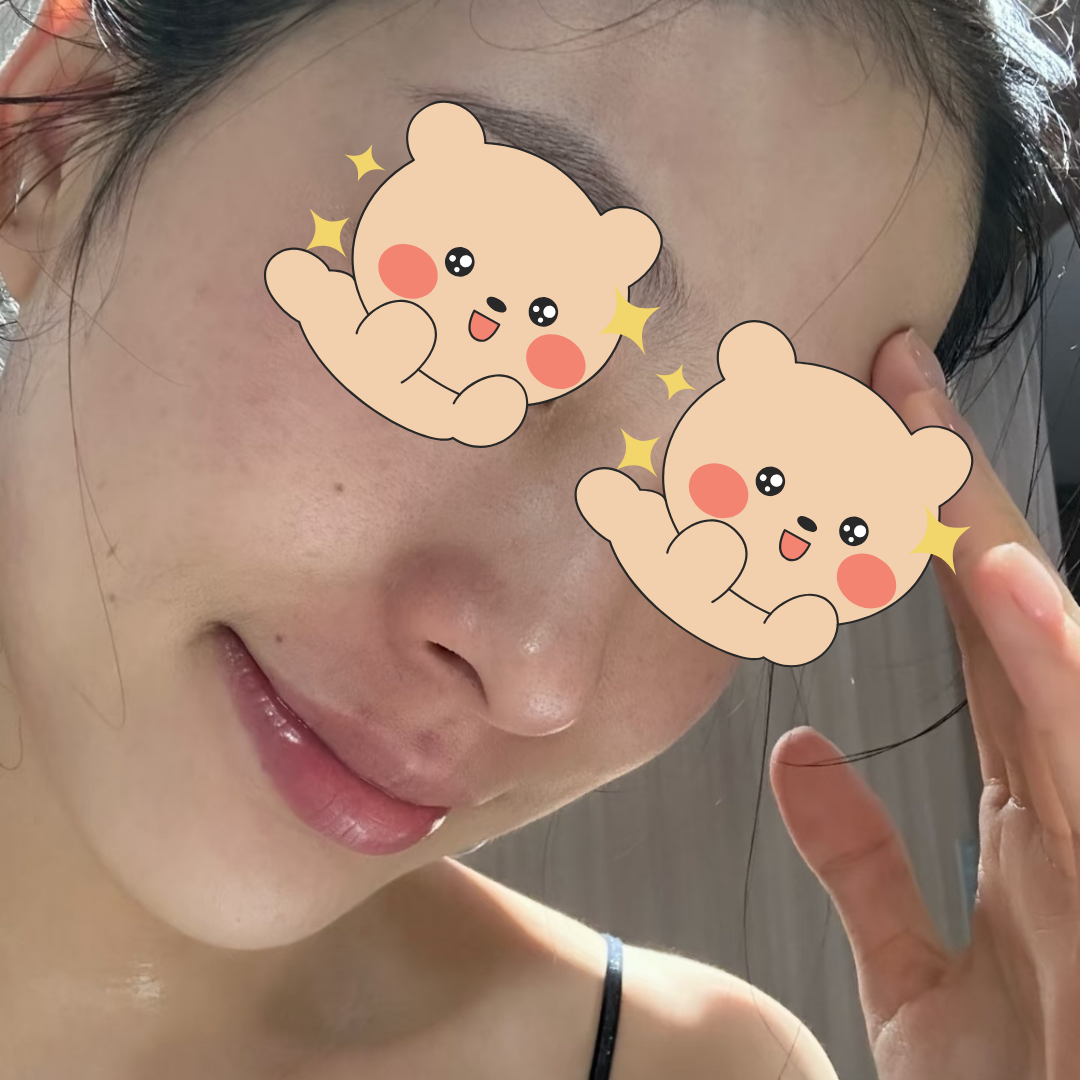 수술후기이미지