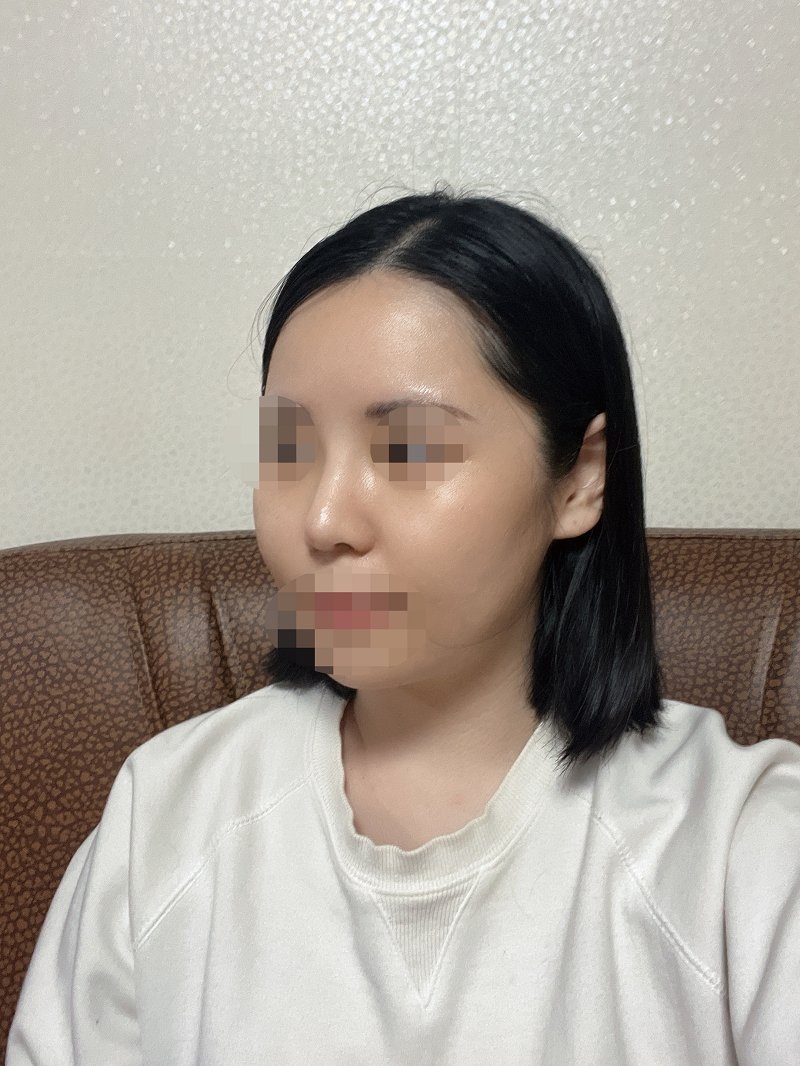 수술후기이미지