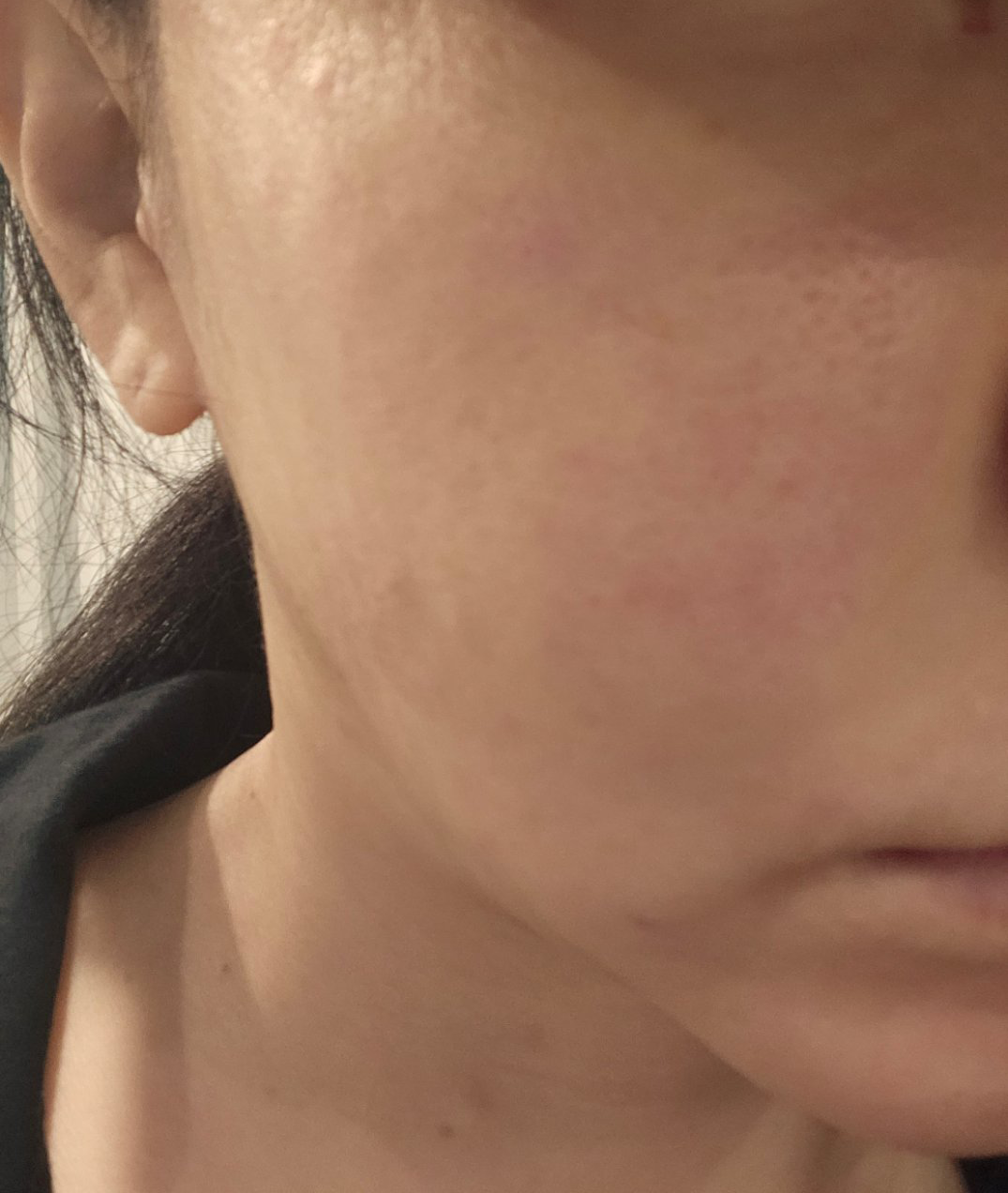 수술후기이미지