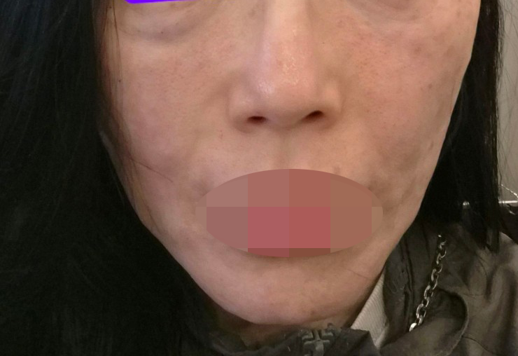 수술후기이미지