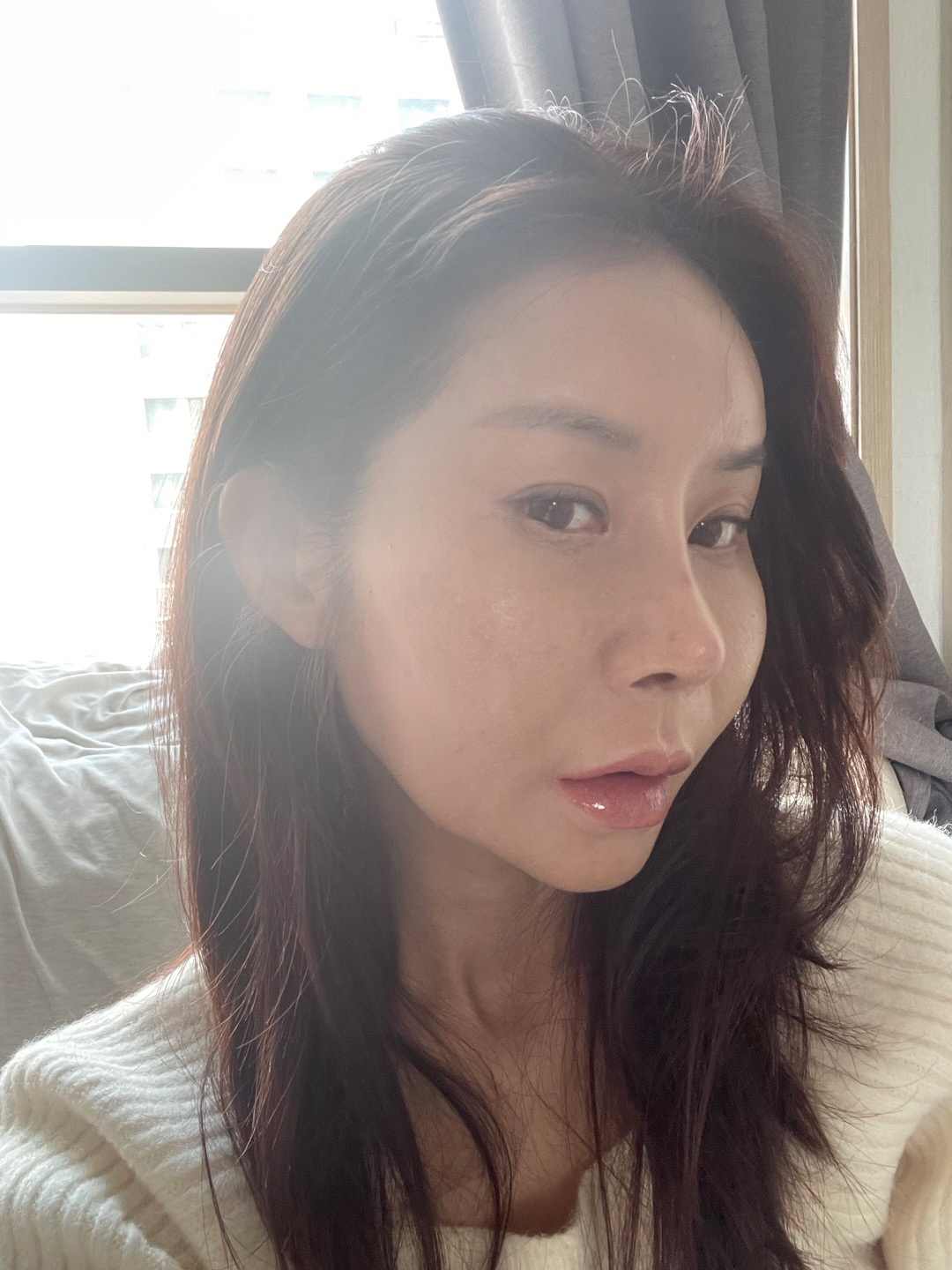 수술후기이미지