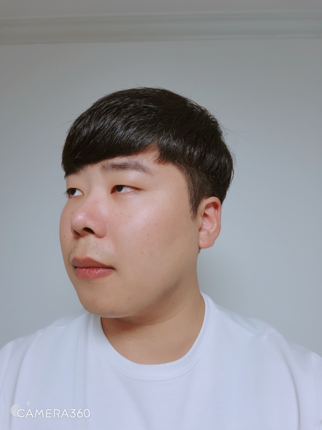 수술후기이미지