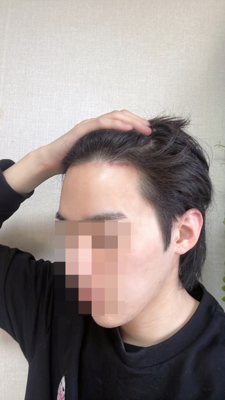 수술후기이미지