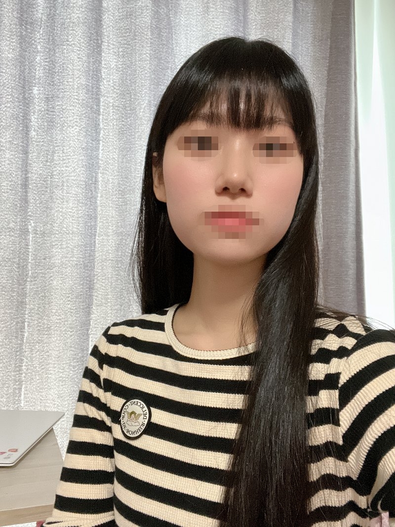 수술후기이미지