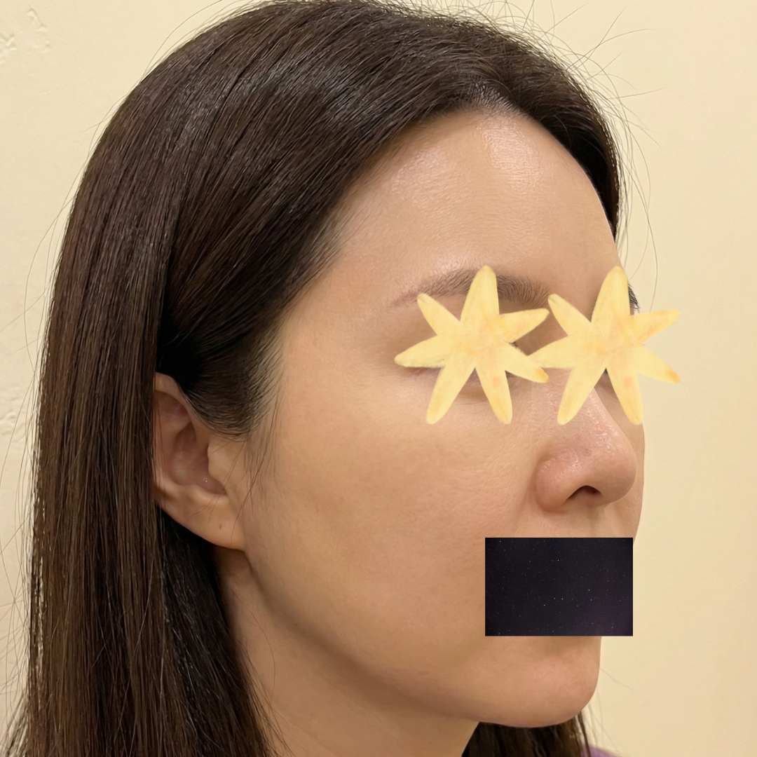 수술후기이미지