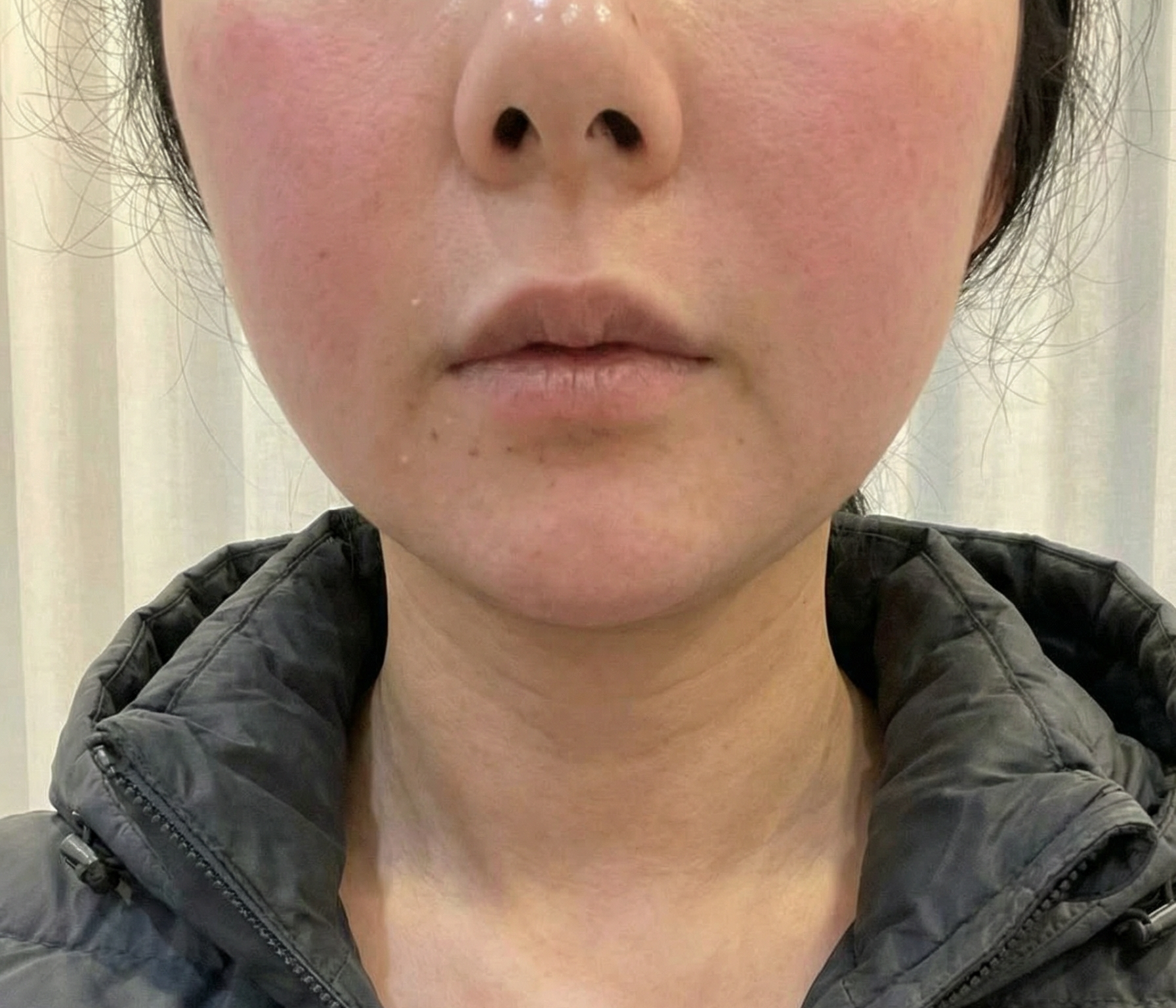 수술후기이미지