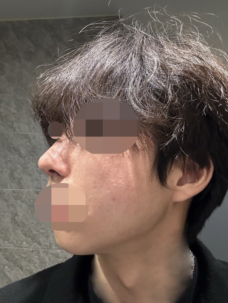 수술후기이미지