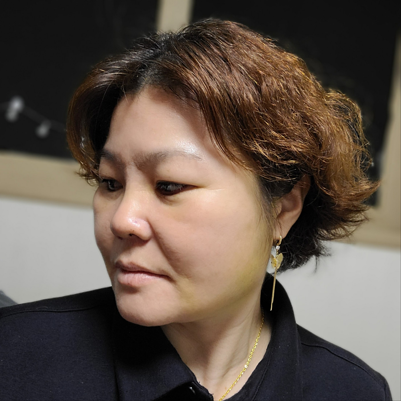 수술후기이미지