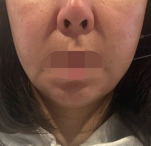 수술후기이미지