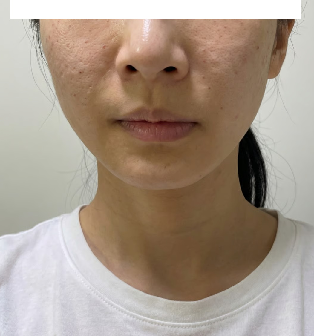 수술후기이미지