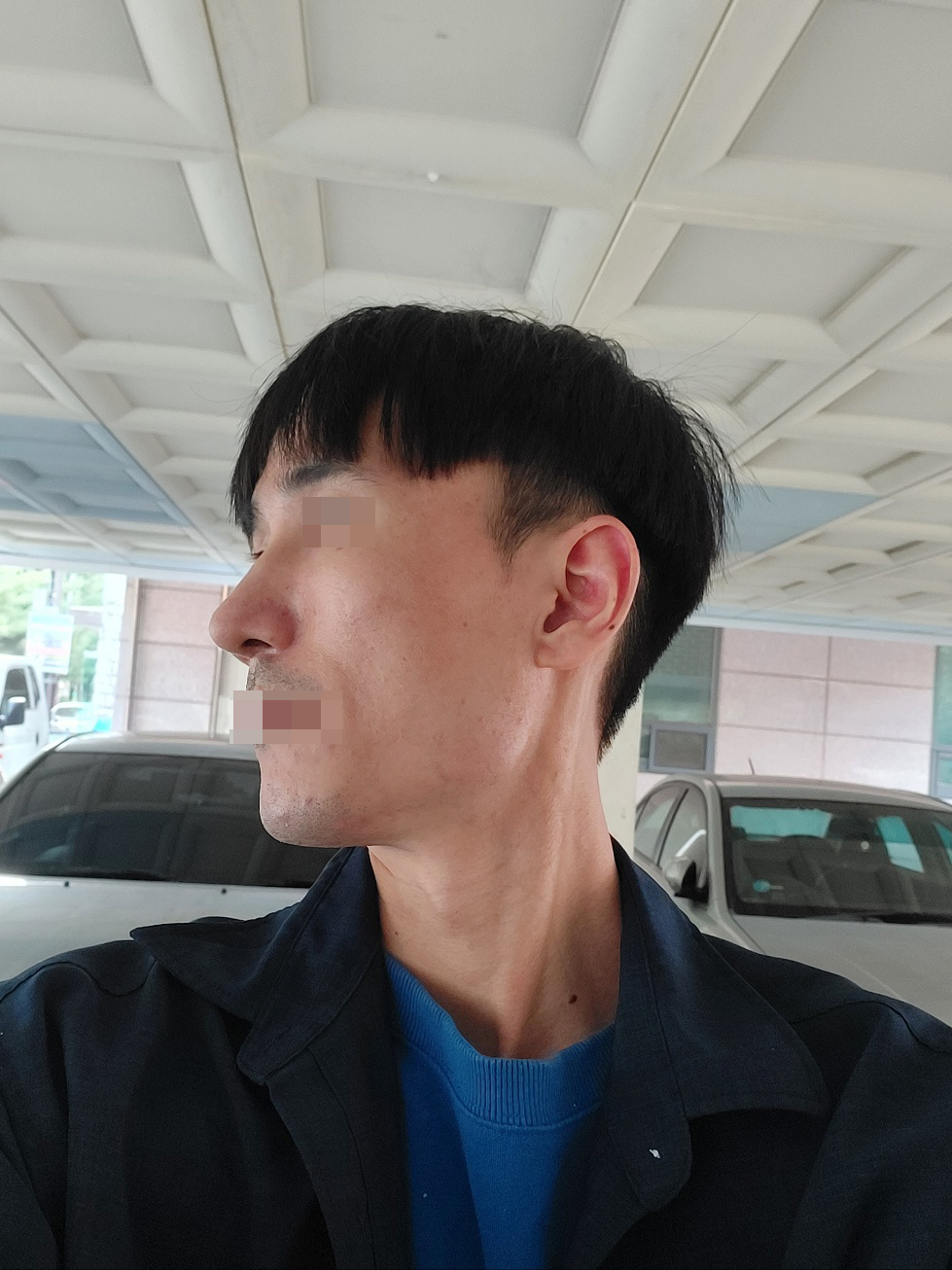 수술후기이미지