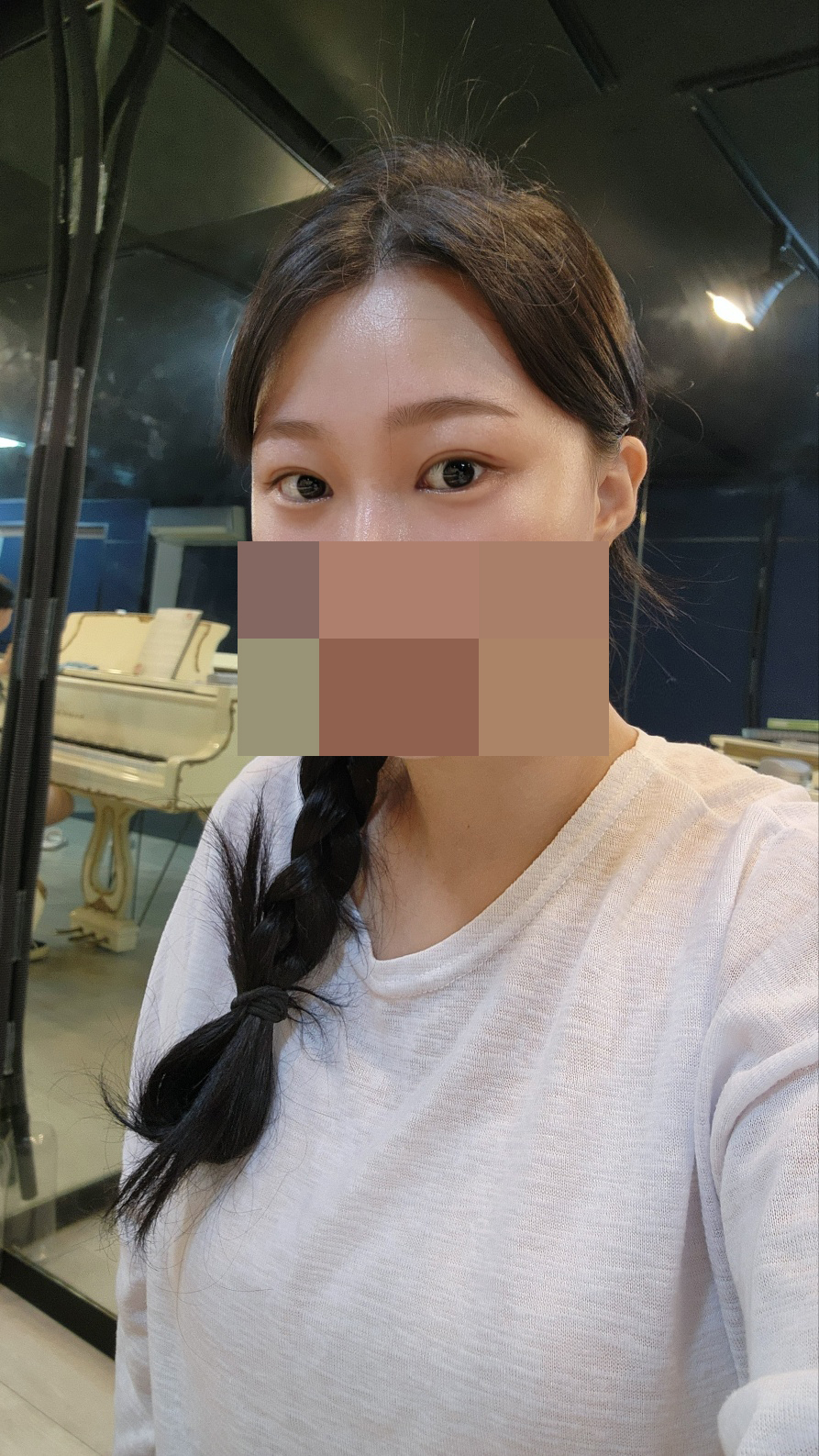 수술후기이미지