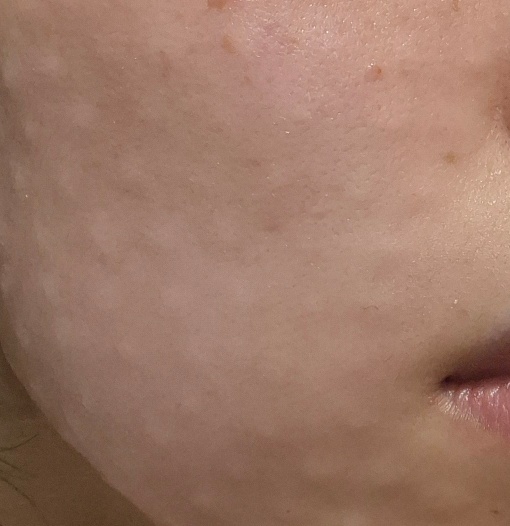 수술후기이미지