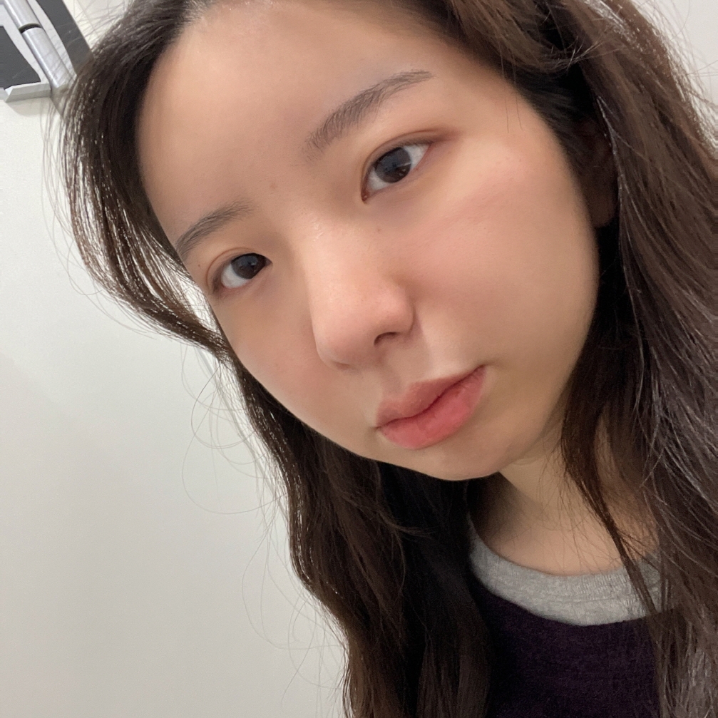 수술후기이미지