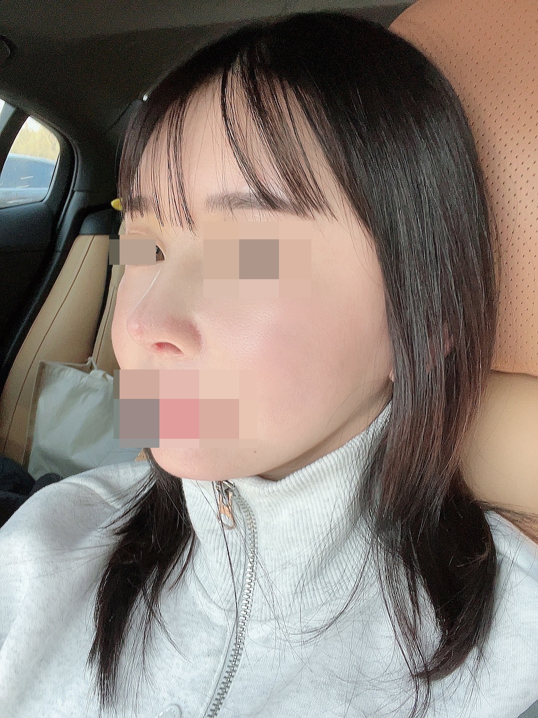 수술후기이미지