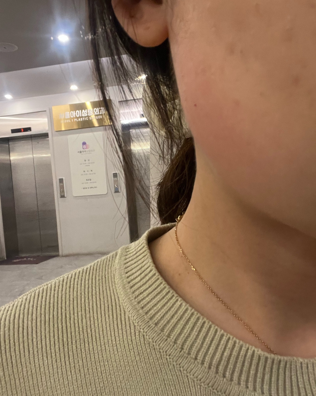 수술후기이미지