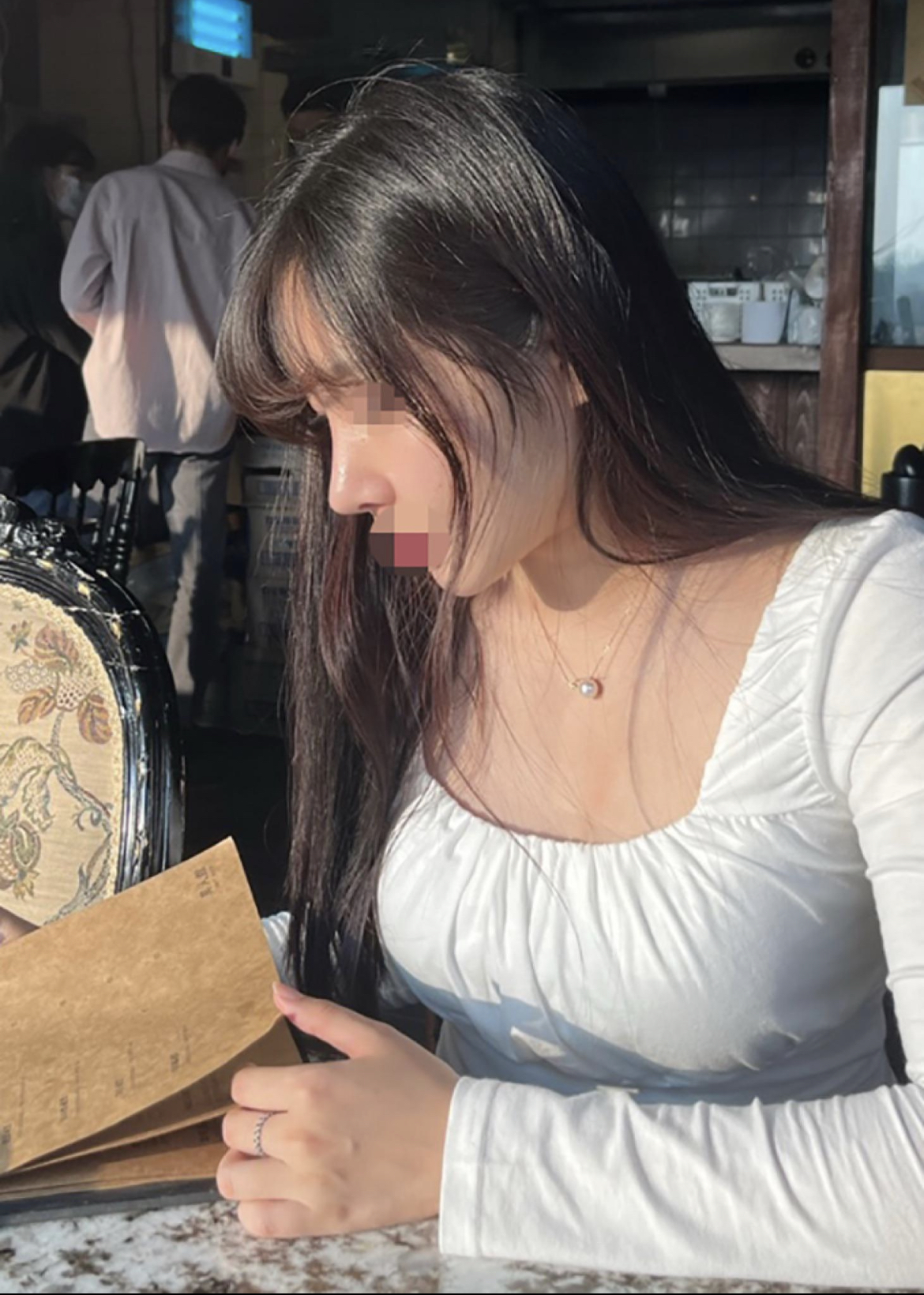 수술후기이미지