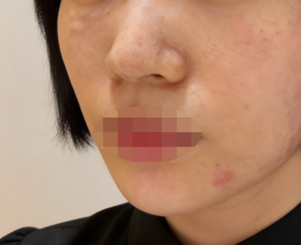 수술후기이미지