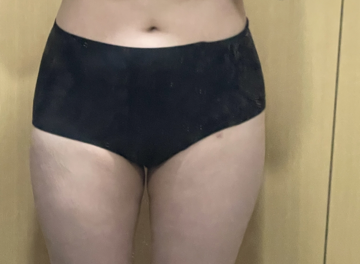 수술후기이미지