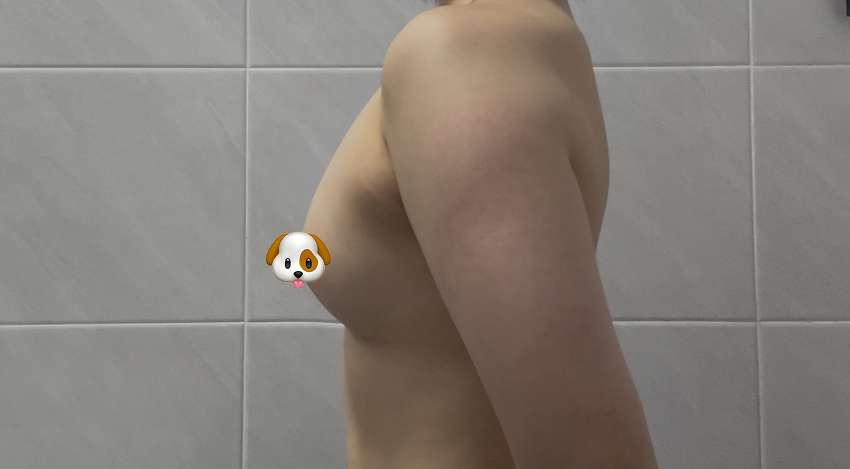 수술후기이미지