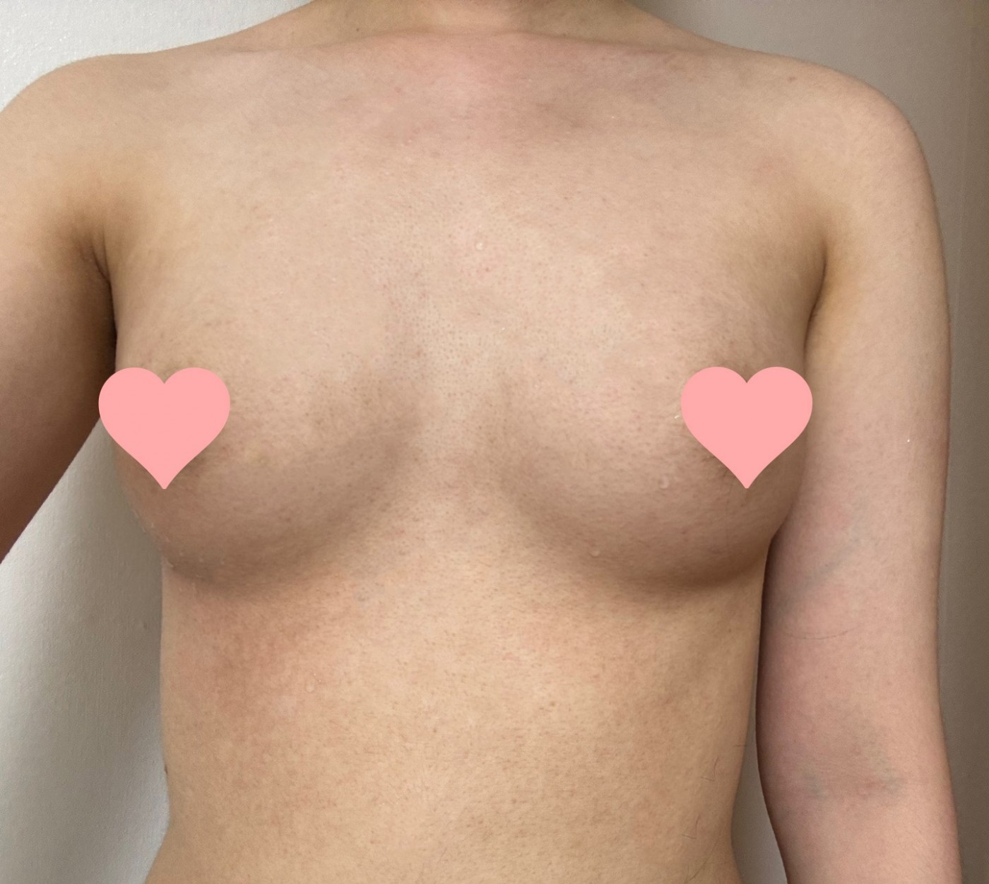 수술후기이미지