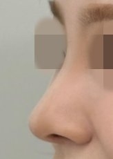 수술후기이미지