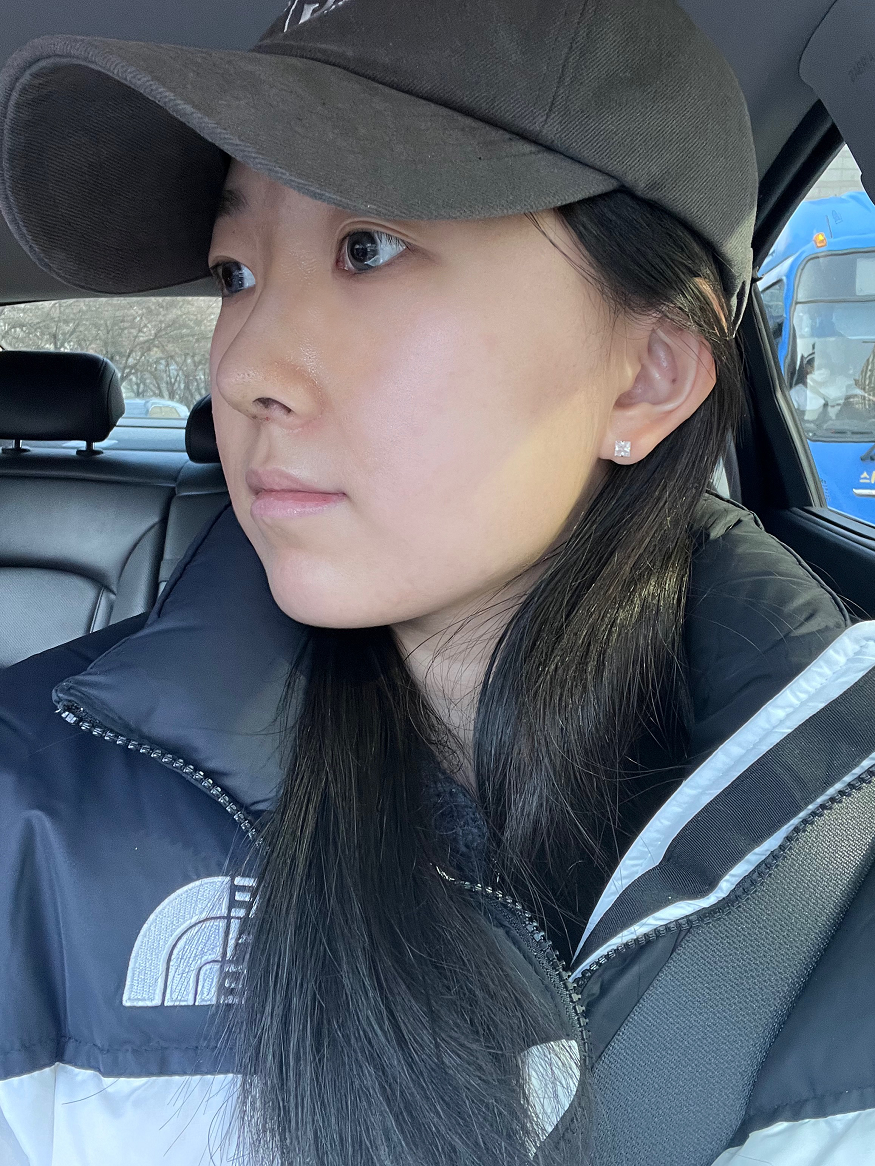 수술후기이미지