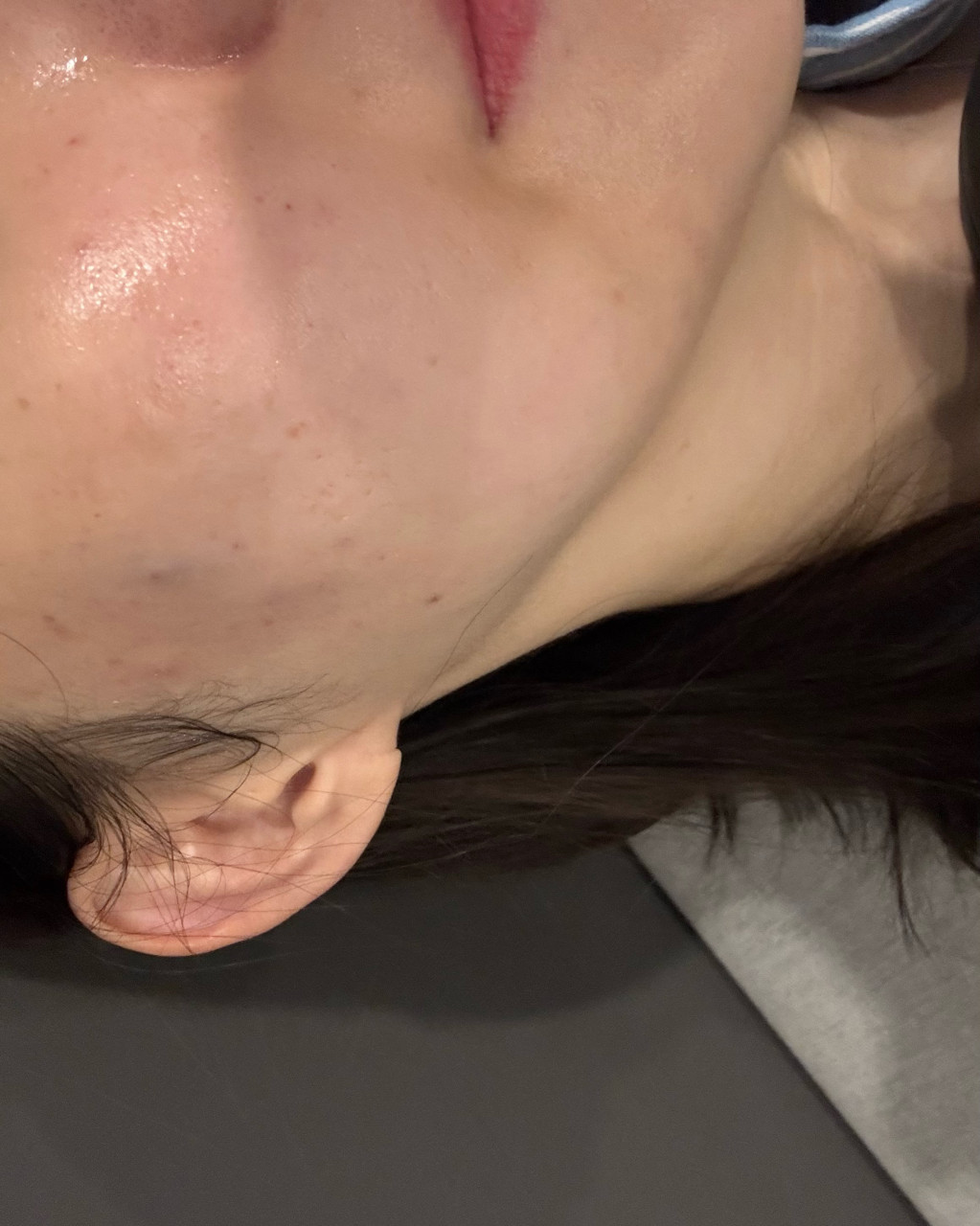 수술후기이미지