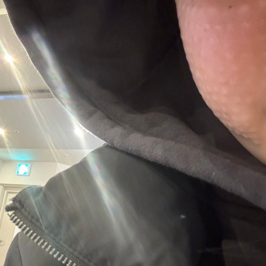 수술후기이미지