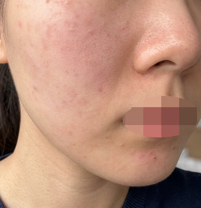 수술후기이미지