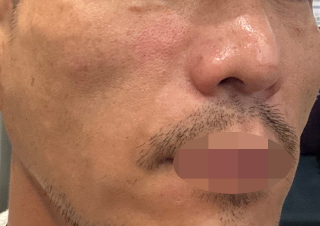 수술후기이미지