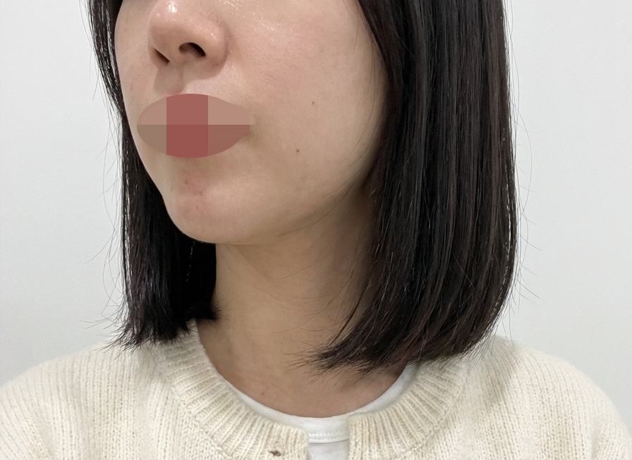 수술후기이미지