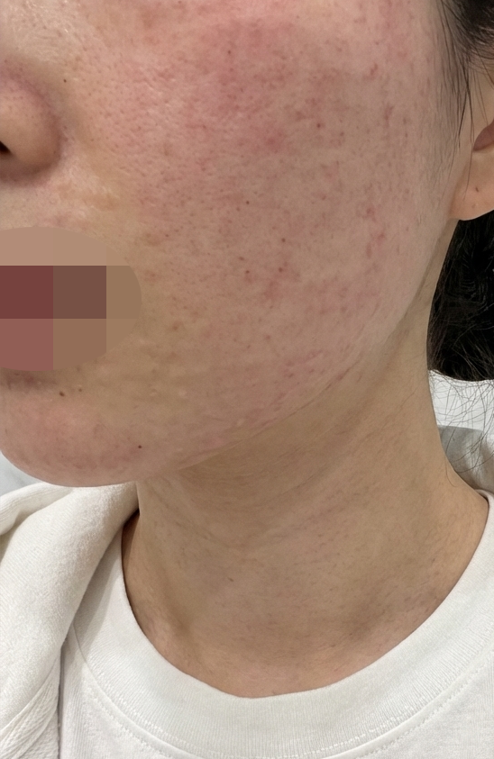 수술후기이미지