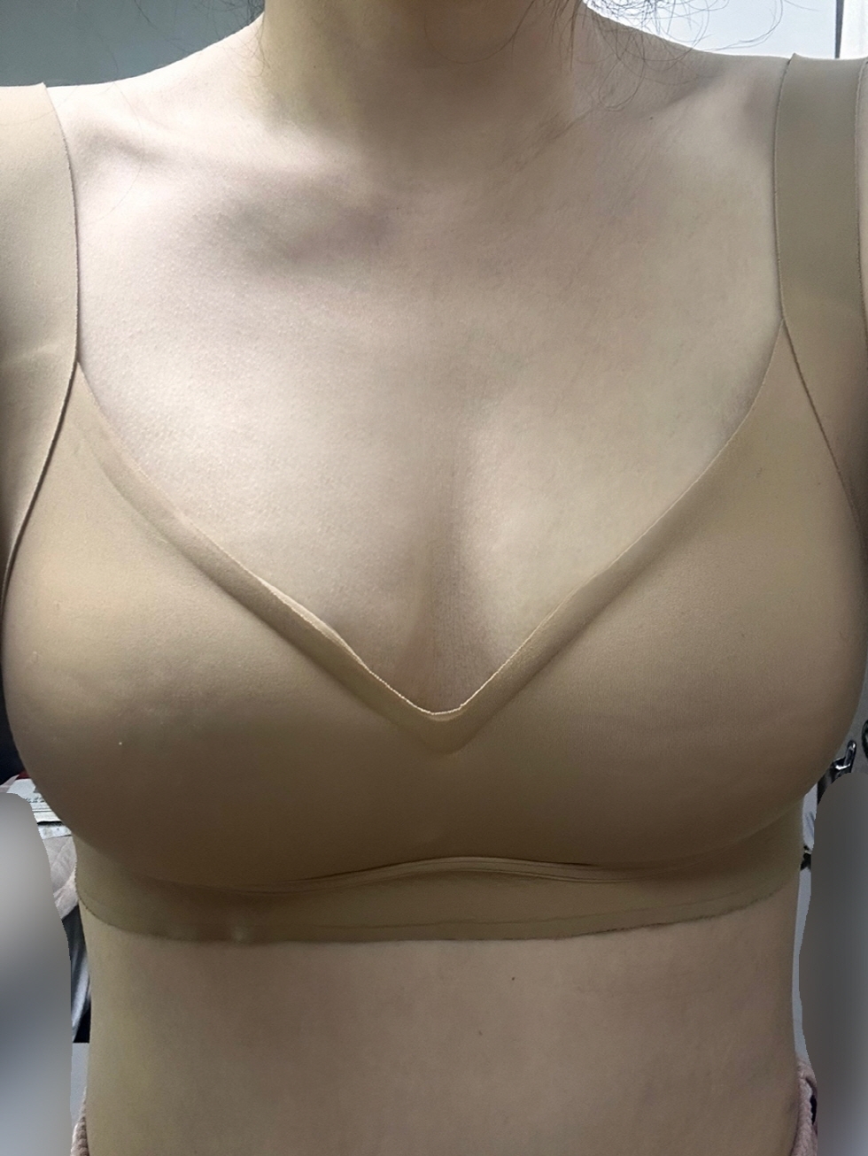 수술후기이미지