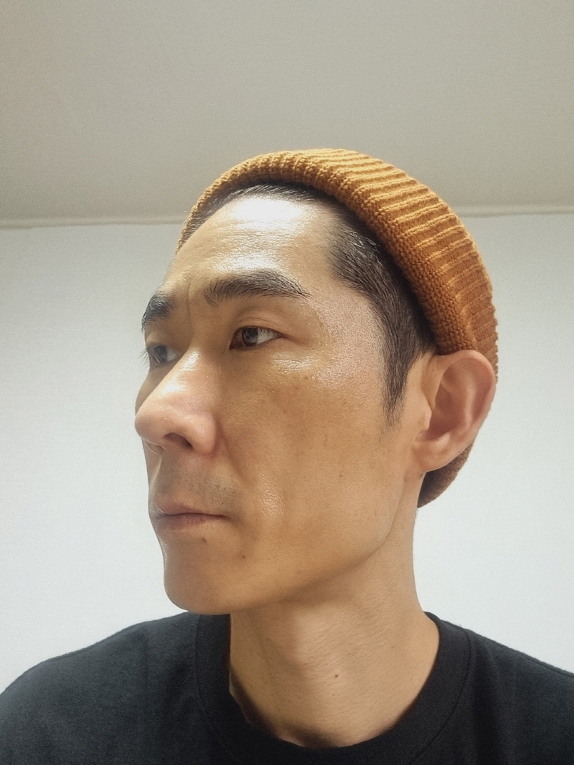 수술후기이미지