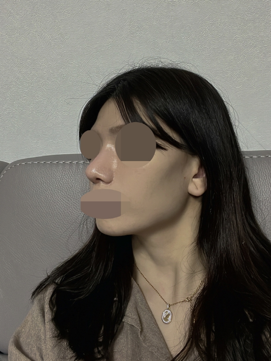 수술후기이미지