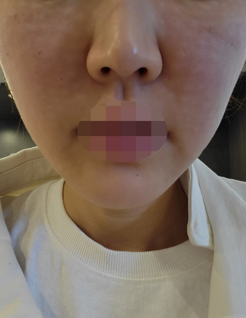 수술후기이미지