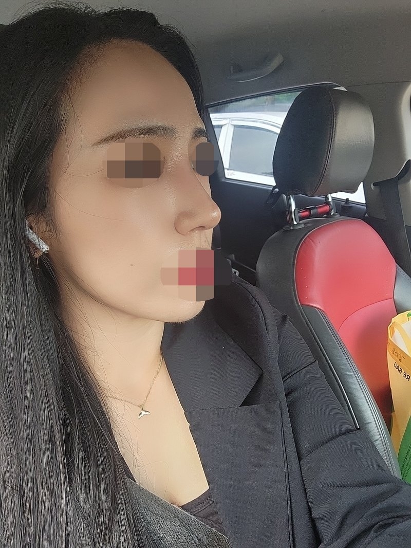 수술후기이미지