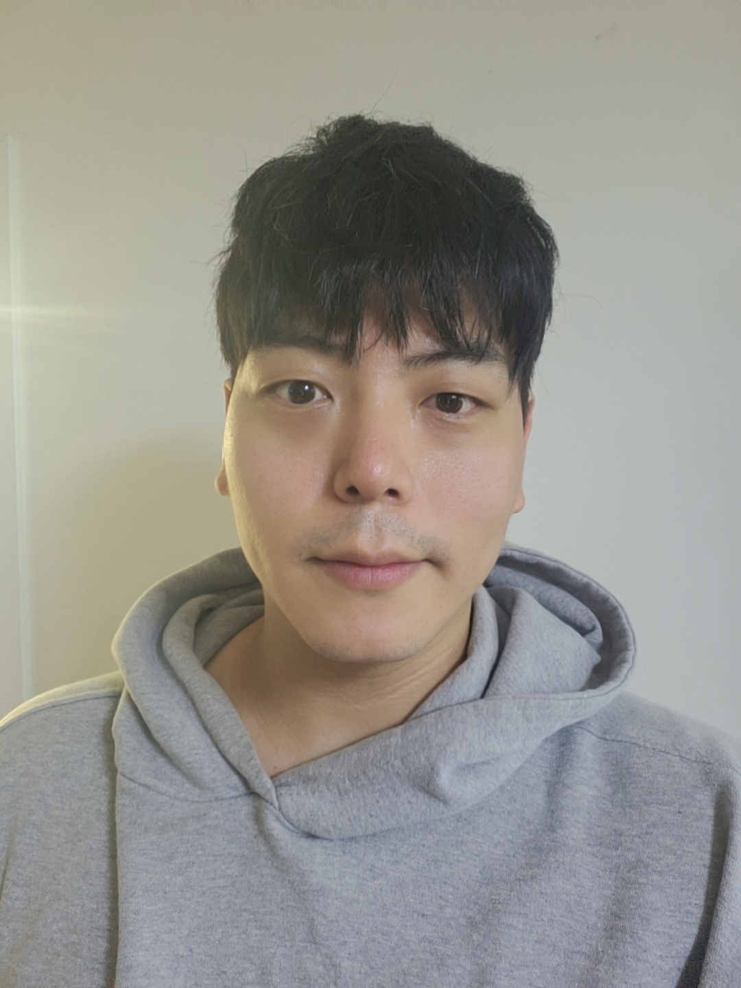 수술후기이미지