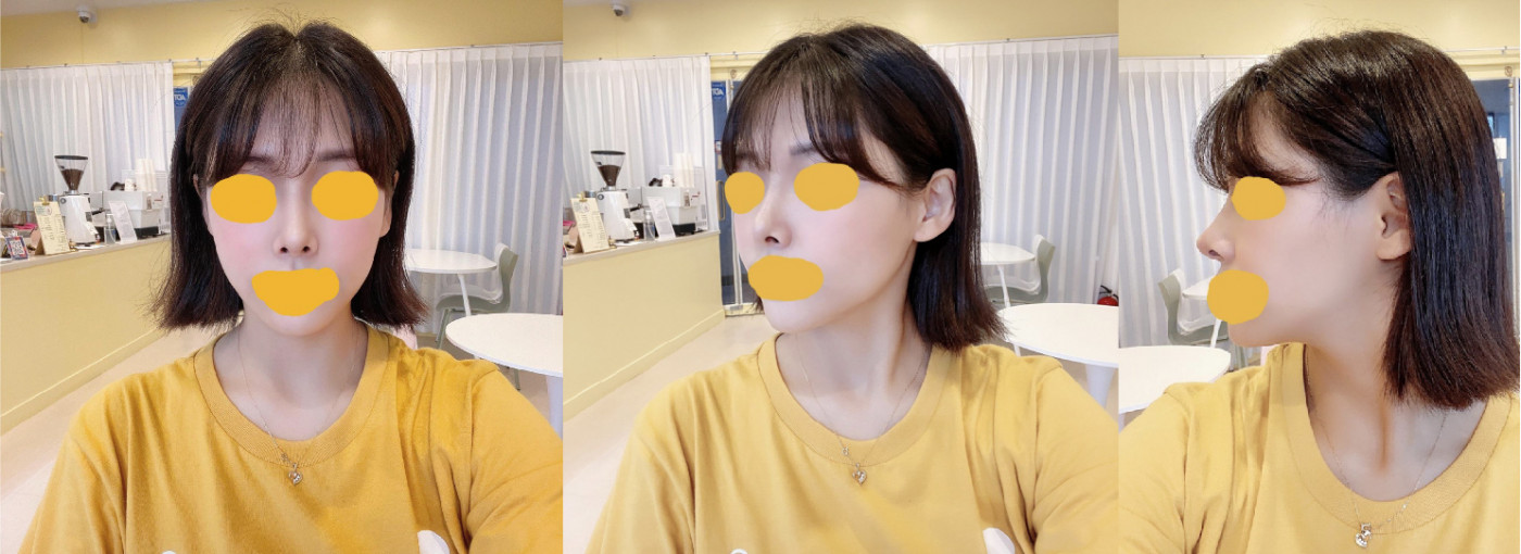 수술후기이미지