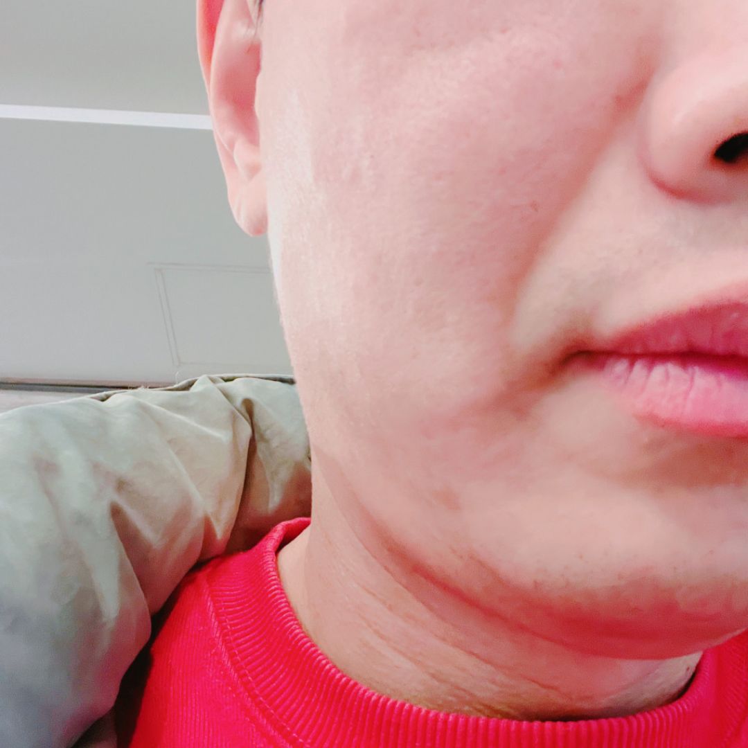 수술후기이미지